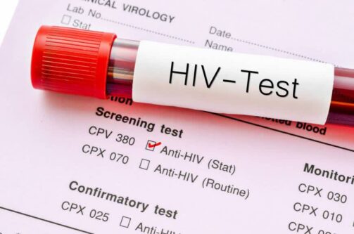 انجام ۶۰۰ تست محرمانه و رایگان، طی پویش ملی HIV در شهرستان دزفول 