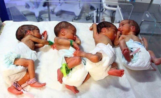 وقوع ۱۰۷ مورد چندقلوزایی در دزفول