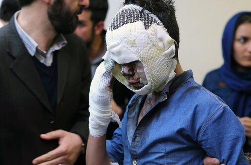 ۷ تن بر اثر انفجار مواد محترقه دچار سوختگی شدند